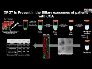 CCF Webinar: Clinical Trials for those with local/regional & advanced cholangiocarcinoma