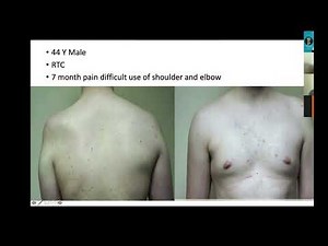 Viva & Clinical Case Discussions for Orthopaedic FRCS Exam (5) | Orthopaedic Academy