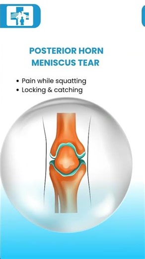 12 common reasons why you may experience pain behind the knee