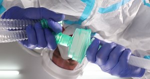 Anesthesiologist Doctor Putting Mask Patient Face Stock Footage Video (100% Royalty-free) 1068822044 | Shutterstock