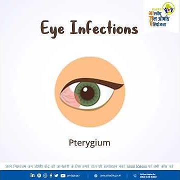 Types of Eye Infections