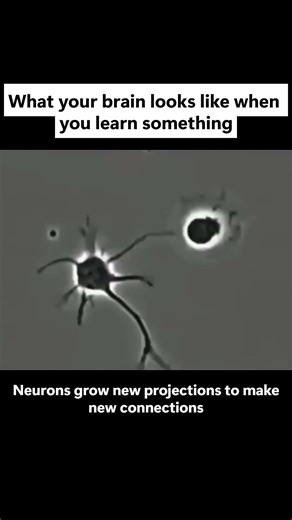 What Your Brain Cells Look Like When You Learn Something NEW 🧠⚡