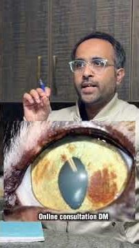 Do you know it can be tumor of the eye?