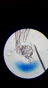 Fresh skin scrapping of dogs showing live sarcoptes and demodex under microscope with 10X and 40X zoom ! Every one must watch and don't neglect please! Samples are collected and processed in clinic! | Fur n Feather Companian Animal Clinic