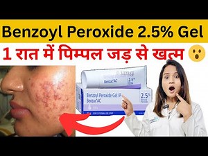 Benzoyl Peroxide 2.5% Gel Se pimple jadh se khatam 7 Din Me | Benzoyl Peroxide Gel Complete Review |