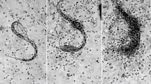 Watch human white blood cells swarm and attack a parasite