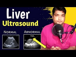 Liver Ultrasound Normal vs Abnormal | Liver Ultrasound Pathology | Liver Cirrhosis Ultrasound videos