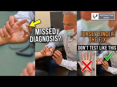 Mastering Jersey Finger Management: Essential Therapy Techniques