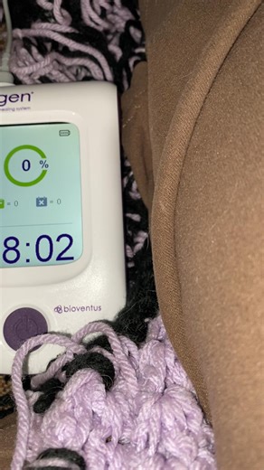 #Exogen #Bonehealth | Paula Dodd Barnes