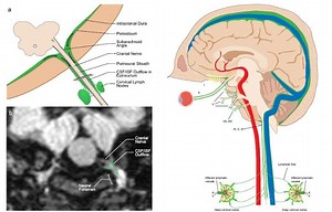 MRI study unveils key details of brain’s waste-removal system »  McKnight Brain Institute » University of Florida