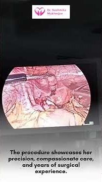 Precision in Practice – Right Ovarian Cystectomy