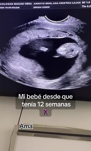 Mi bebé desde el vientre: Un viaje tierno de embarazo