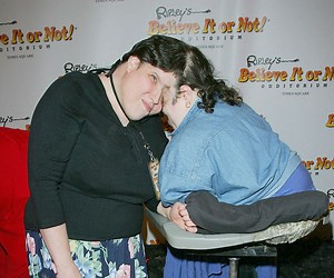 Les jumeaux siamois les plus âgés du monde, Lori et George Schappell, sont morts