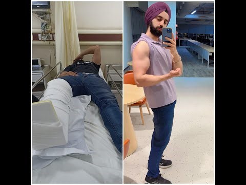 Femur Fracture Recovery – Learning to Walk Again