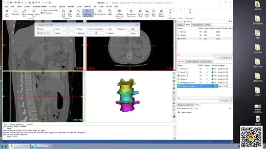 mimics椎间盘建模教程录播-多层提取法