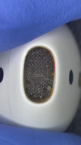 181K views · 701 reactions | #satisfying Apple #AirPods #cleaning | Phone Fix Craft | Facebook