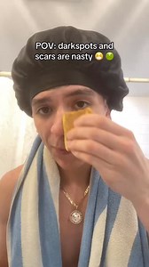 50 reactions | Dark spots? Nasty work. ‍ But if you were using our Turmeric Soap, you wouldn’t even know her. 識 This bar clears it all—face, body, even the stubborn spots nobody wants to talk about. Tap the link in bio or head to richandclear.org to shop now. #RichAndClear #TurmericSoapTruths #ByeDarkSpots #NoGatekeepingGlow #ClearSkinCrew #GenZSkincare | Rich & Clear Skincare | Facebook