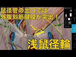 【浅鼠径輪】鼠径管の出口では外腹斜筋腱膜が突出！