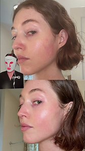 LED mask vs panel: Which actually transformed my skin?