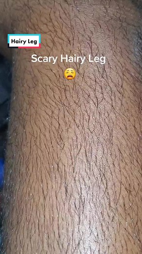 Dealing with Hairy Legs: A Look at Women's Hairy Leg Fashion