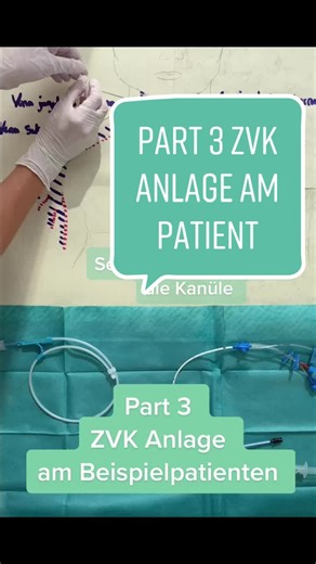 Understanding ZVK Placement and Care in Nursing
