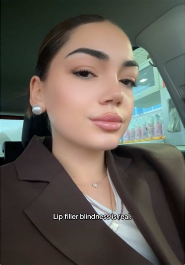 Lip Filler Blindness: Understanding the Risks