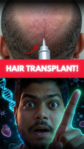 Hair Transplant Close-Up 😱 Thousands of Grafts Implanted in Minutes | Real Medical Process