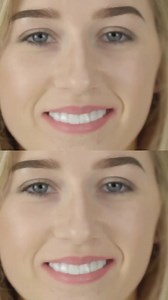 A smile makeover that doesn’t break the bank - and our lowest price ever! Instasmile offers a more affordable alternative to traditional veneers, without compromising on style or comfort - and you don't have to leave your home to get it! 👉 Your new smile is closer than you think - Head to the website now. #AffordableSmile #Instasmile #SmileOnABudget #VeneersAlternative #SmileGoals | instasmile