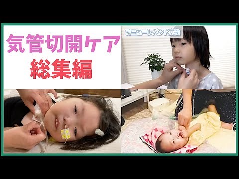 [All at once!] What is a tracheotomy? / Band replacement / Cannula replacement / Suction
