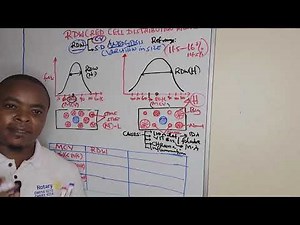 CBC| RDW-CV & RDW-SD | Red cell distribution width Explained | Haematology