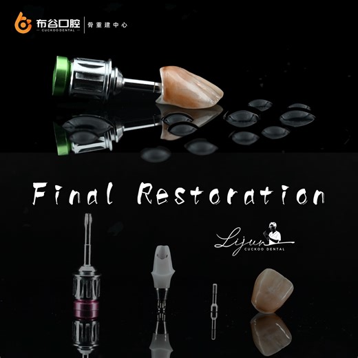 Jun Lee on Instagram: "Vertical bone augmentation in the esthetic zone is a step-by-step journey. From hard tissue reconstruction, to second-stage soft tissue conditioning, and finally to the fabrication of the definitive restoration — every single step matters. Precision at each stage determines the final esthetic and biological outcome."