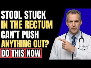Stool STUCK In The RECTUM? Here’s What To Do Immediately!