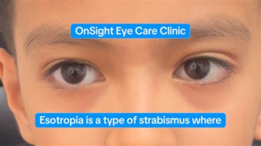 11 reactions | Esotropia is a type of strabismus where one or both...