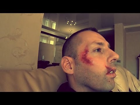 Harald Baldr Exposed In Fight or Scam in Atlanta ? 🇺🇸