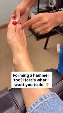 Forming a hammer toe? Here’s what I want you to do!