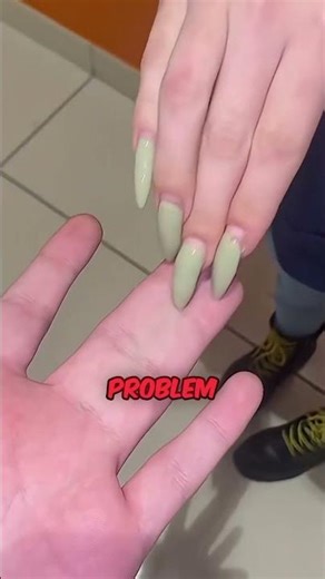 Born With Joined Fingers, Girlfriend's Reaction! 🤯