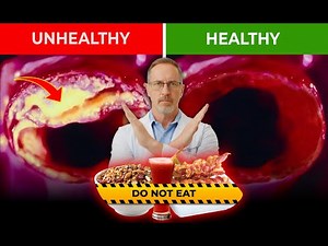 Seniors, 5 WORST Foods Clogging Your Arteries Without You Knowing