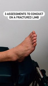 11K views · 71 reactions | Graphic foot content 濫 | The Medical Lounge | Facebook