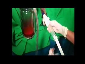 Panickers PPH Suction Device