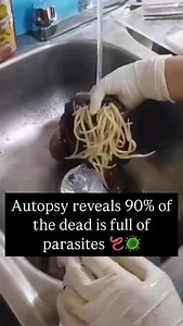 13K views · 153 reactions | 匿 “What they found during autopsies...