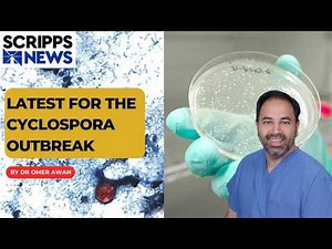 Cyclospora Outbreak Update: Is Lettuce Safe to Eat? Food Safety Facts Explained