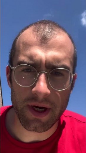The Journey Of Going Bald (in 567.5 Days)