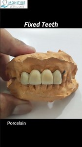 Missing Front Tooth? See This Stunning Tooth-Coloured Fix !