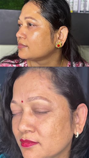 AloeHerbal Skincare for Natural Skin Glow