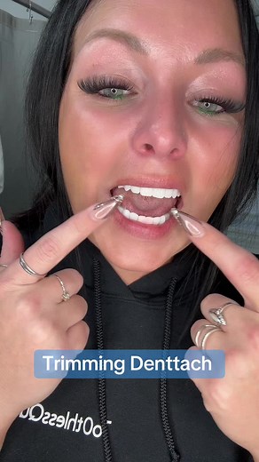 Trimming Denttach from Denture: How-To Video