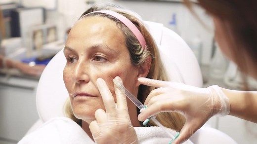 Juvéderm® VOLITE™ Facial Rejuvenation Intradermal Filler - Expert Talk