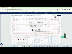 Denti.AI Voice Perio for Dentrix Ascend