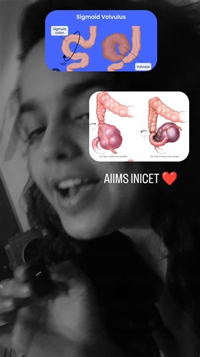 DrsushMBBS on Instagram: "AIIMS INICET PREPARATION UPDATE MOST PREDICTED #trending #reelitfeelit #reelsinstagram"