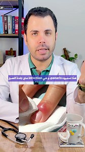 Le panaris | Doc Tube / الطب في كلمة