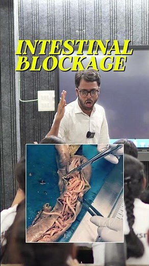 Ascariasis Revision | Human Health & Disease | Class 12th Biology NCERT | NEET | CBSE | Ankit Sir